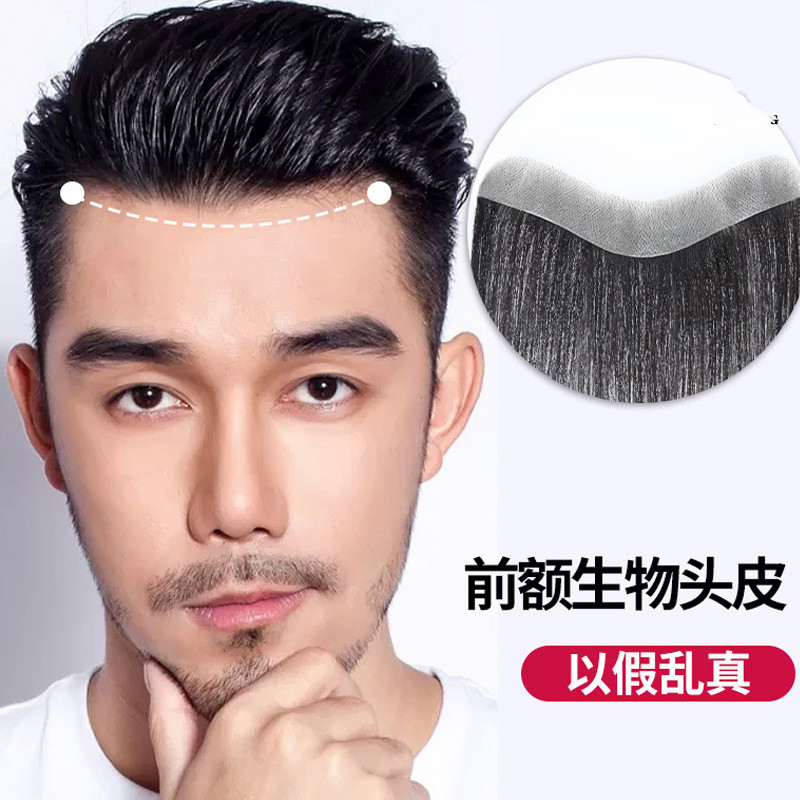 唐妮 假发男发际线假发贴真发隐形自然m型高额头男士 前额补发片SYN V形2.5*17发长15厘米