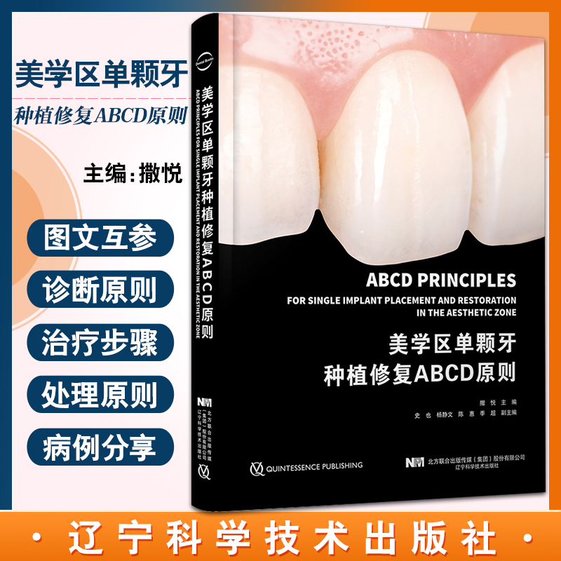 美学区单颗牙种植修复ABCD原则 从种植诊断决策外科和修复治疗方面阐述美学区种植修复原则 撒悦 9