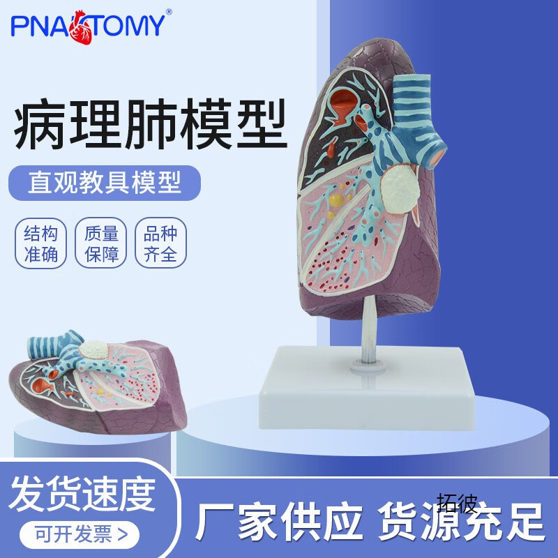 人体病理肺模型仿真吸烟者肺部内脏器官标本胸外科呼吸科教学 呼吸科