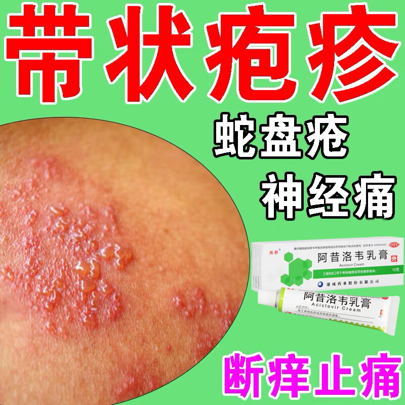 阿昔洛韦乳膏 3%*10g 阿昔洛韦乳膏治疱疹病毒单纯带状疱疹水泡水痘