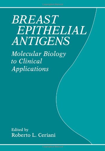 预订 breast epithelial antigens