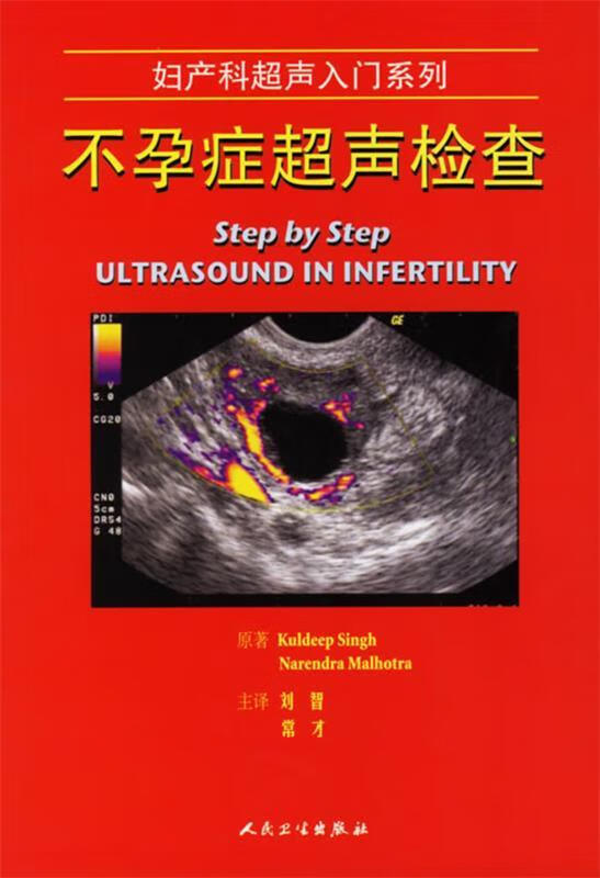 不孕症超声检查