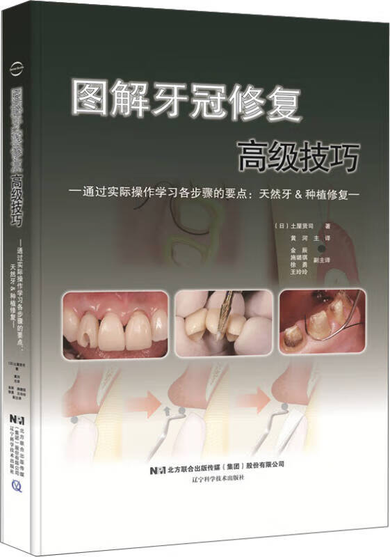 【正版书】图解牙冠修复高级技巧