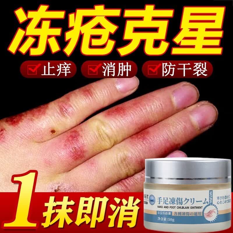 和风雨日本京都冻疮膏伤皲裂膏手足干裂修护霜成人治根儿童肿消止痒