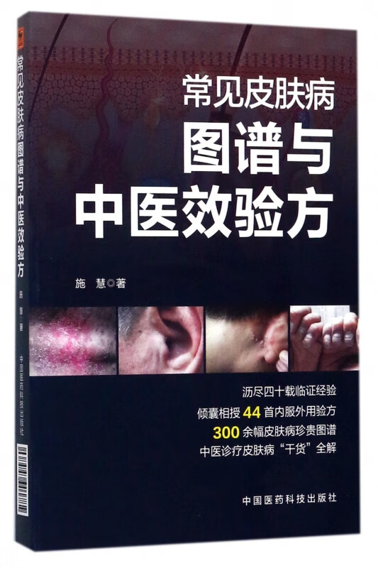 常见皮肤病图谱与中医效验方