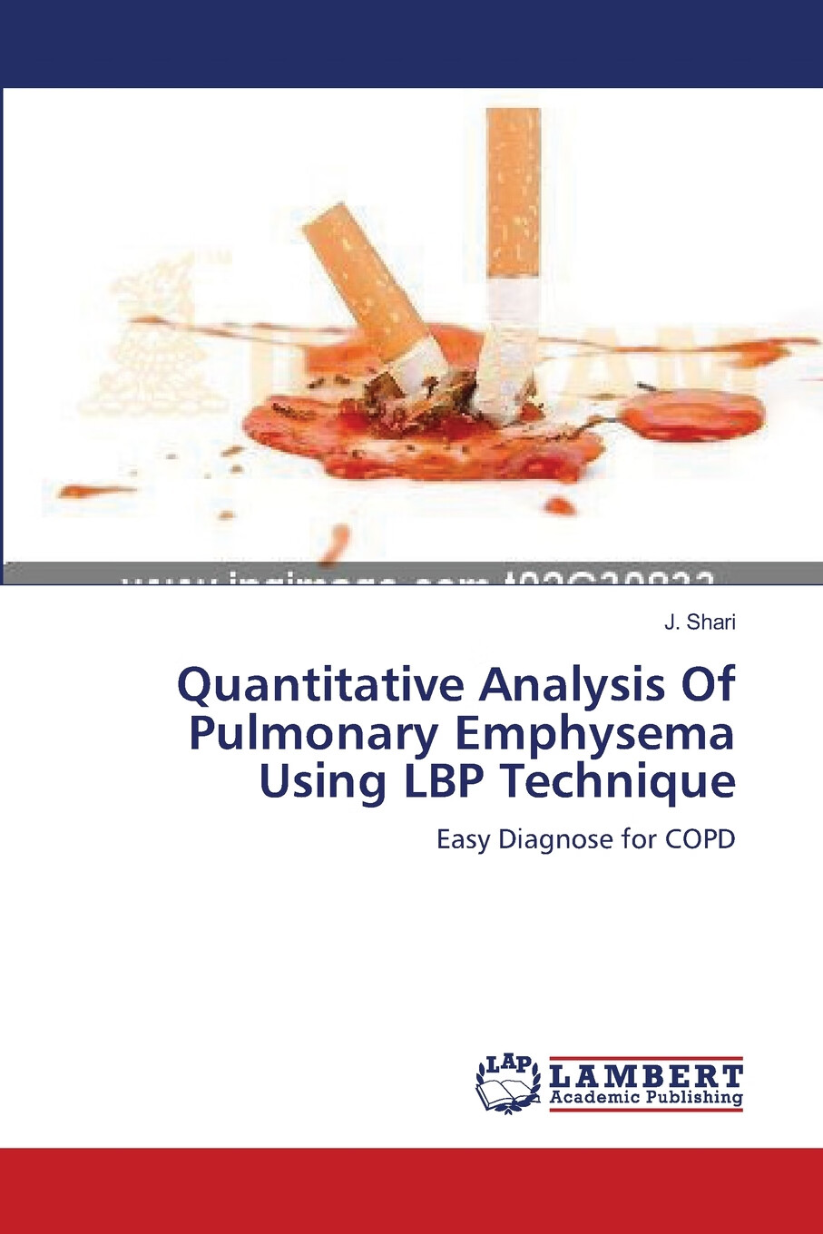 【预售按需印刷】quantitative analysis of pulmonary emphysema