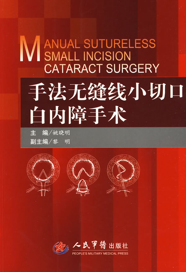 手法无缝线小切口白内障手术【放心选购】