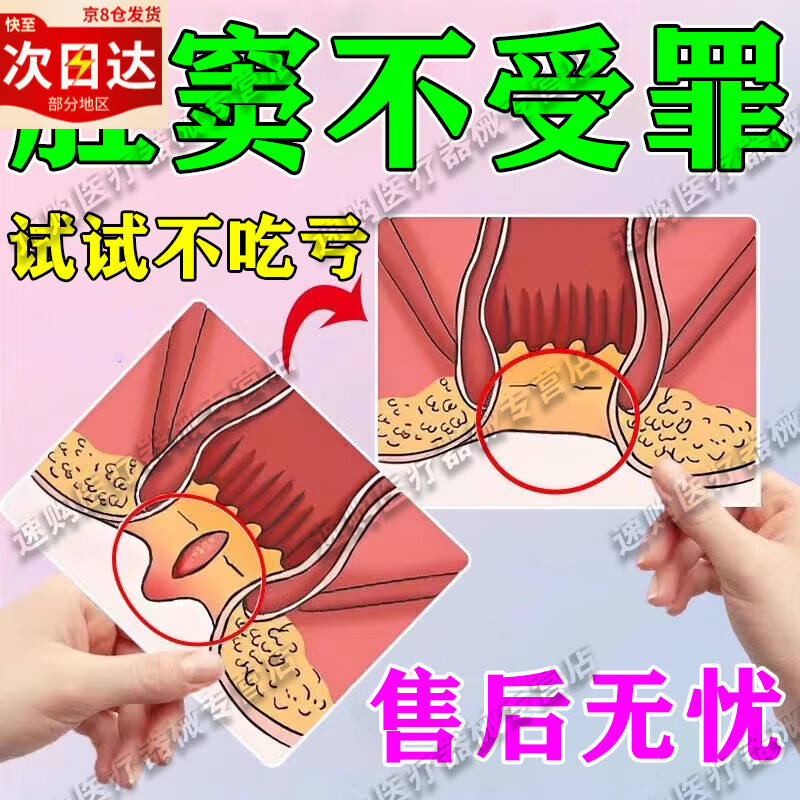 肛窦炎内痔用药肛门痛止疼痛消肿肛瘘伤口愈合内口封口膏治疗肛周 1盒