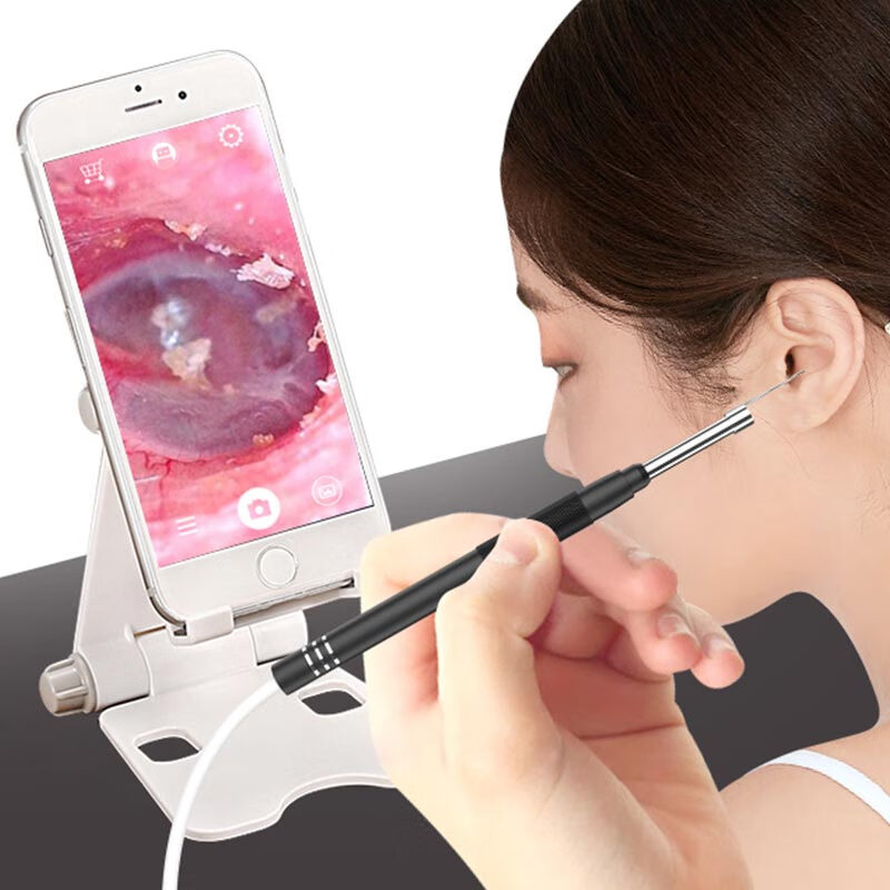 运锋plp采耳可视挖耳勺掏耳专业掏耳朵高清内窥镜儿童抠耳屎耳镜wt