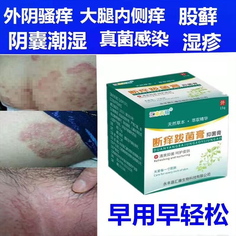 男士阴囊潮湿女私处干痒男士私处瘙痒肛周止痒大腿内侧痒膏治的屁股痒