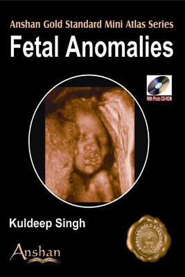 预订 fetal anomalies [with cdrom]