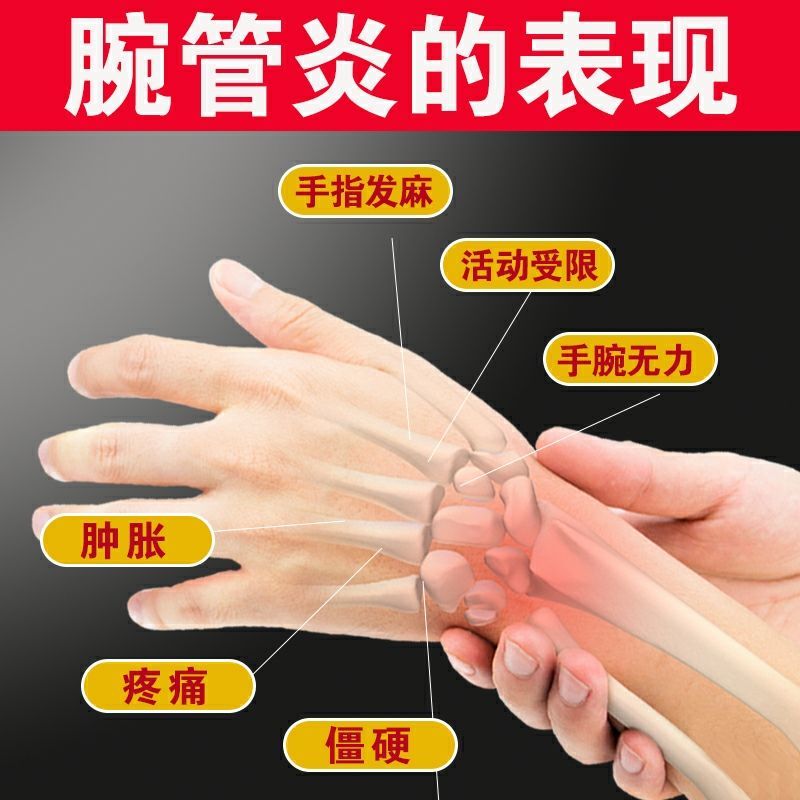 腕管综合症正中神经损伤手腕手指无力麻木夜间疼痛腱鞘囊肿专用贴 3盒