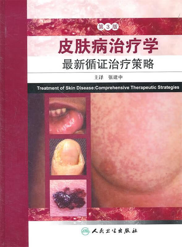 皮肤病治疗循证治疗策略