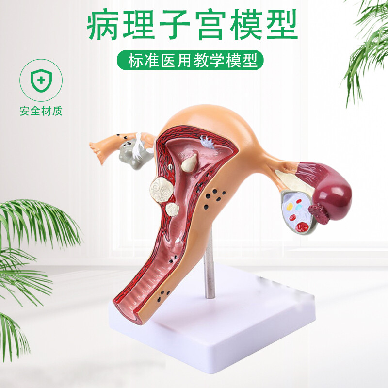 jd健康人体模型女性生殖子宫卵巢子宫教学模具病理变化科普培训教