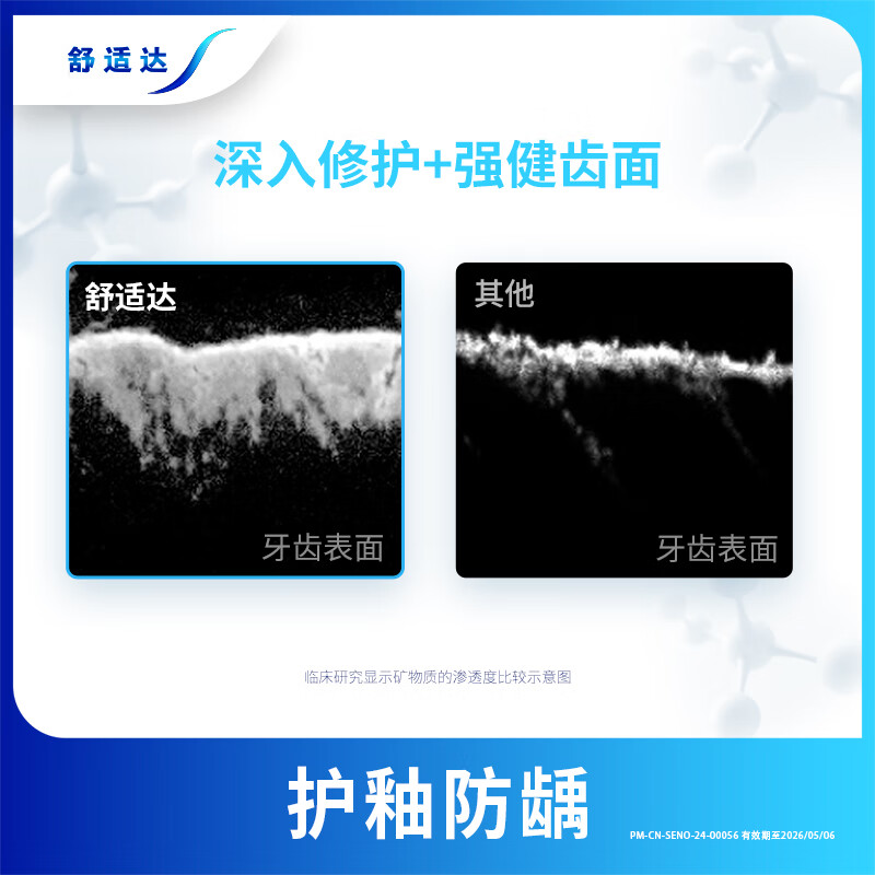 舒适达牙龈护理抗敏成人牙膏100g 含氟防蛀固齿护龈清新口气 京东自营
