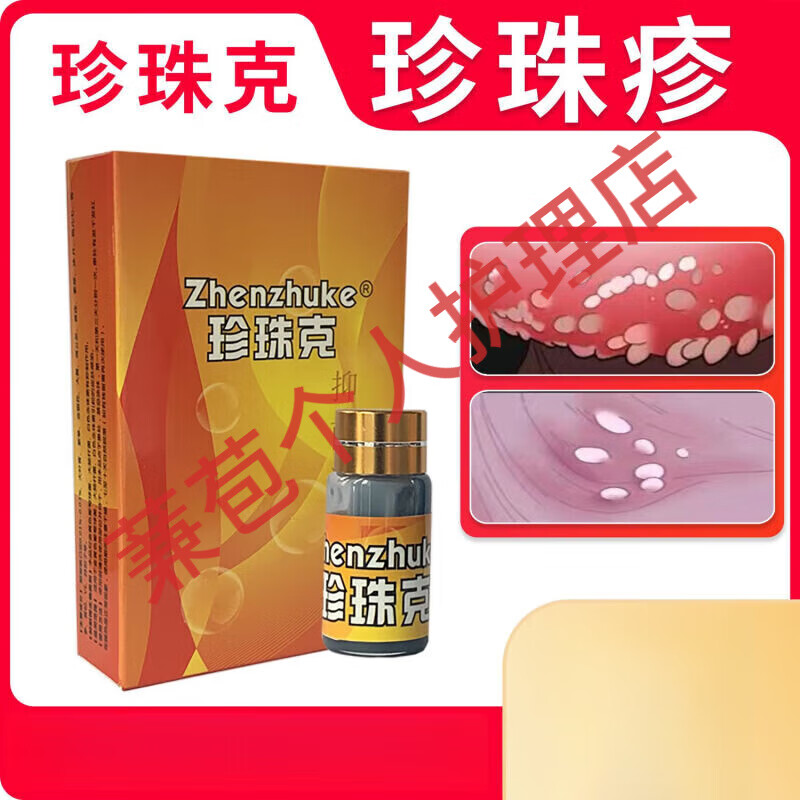 奇力康珍珠克珍珠疹软膏男性私处冠状沟粒疹系带样处珍珠样 5ml