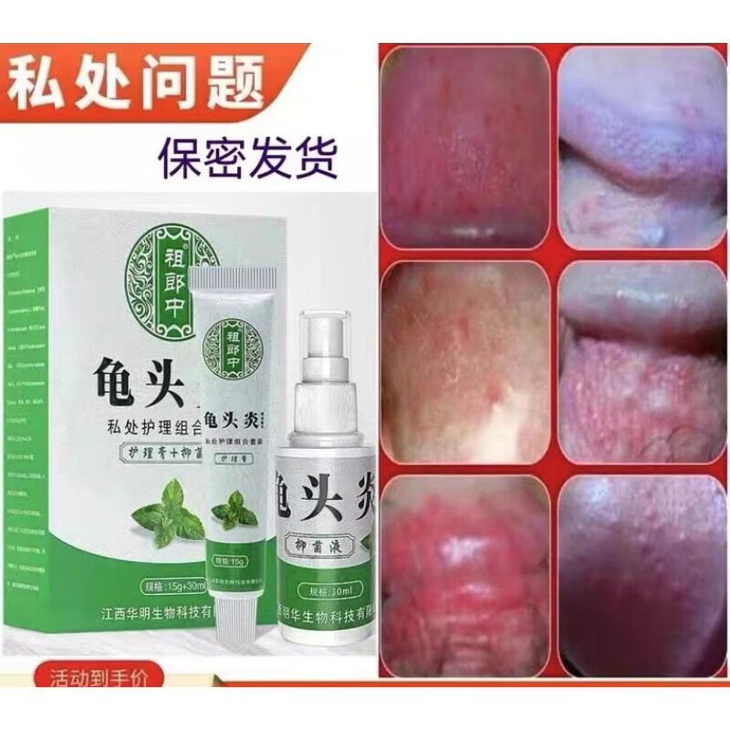 男科包皮破裂尿道口红肿刺痛痒阴囊瘙痒喷雾乳膏痒喷雾乳膏痒喷雾乳膏