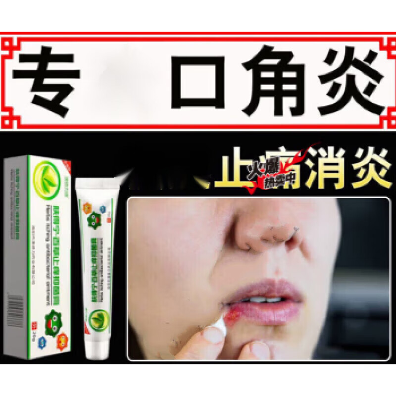 澳德力康嘴角溃烂软膏口角炎修复膏烂嘴角秋冬干裂开裂起泡溃烂疼痛红肿发 买3+2【五盒巩固装】，
