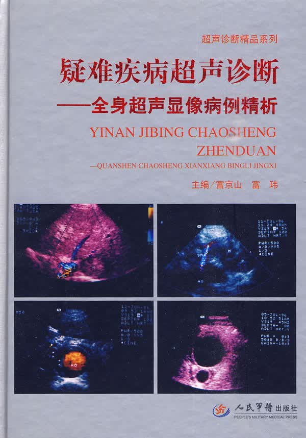 疑难疾病超声诊断--全身超声显像 富京山 人民军医出版社 9787509132944