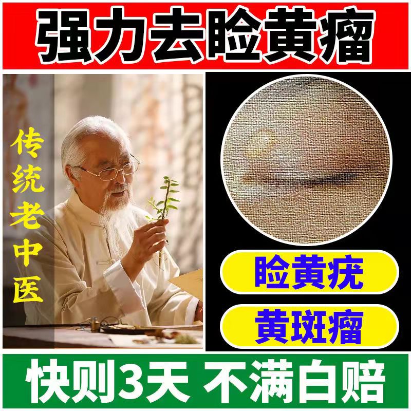 去除睑黄疣长黄色瘤眼部黄睑疣瘤睑黄瘤斑膏圆眼睑黄斑瘤健康膏
