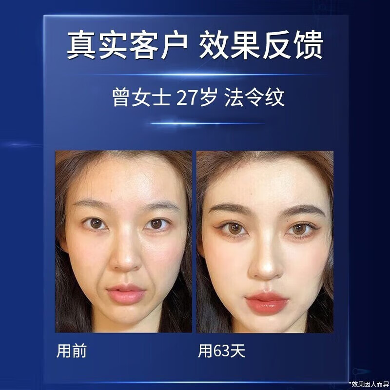 H18抗皱面霜女士抗皱嫩肤霜法令纹抬头纹男衰老保湿提拉紧致 【买1送 1】消除去除