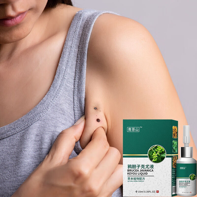 克疣液扁平丝状跖疣瘊子猴子小肉粒疙瘩用药肉刺鱼鳞痣 一盒