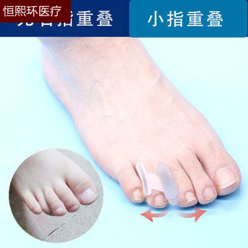 第四个脚趾中指压无名指脚趾器下弯曲重叠变形可走路内翻 第四个 曲