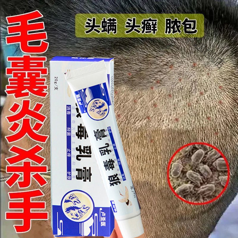 毛囊炎克星头部毛囊炎头皮毛囊炎头部毛囊炎头上毛囊炎毛囊炎背部 1