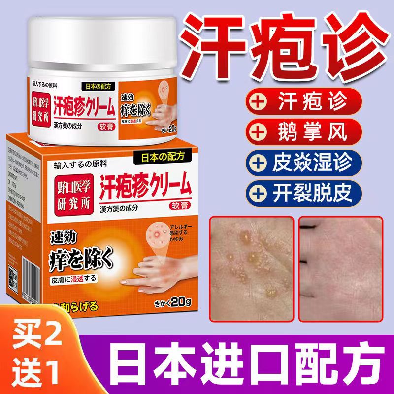 享源康汗l疱l疹手上小水泡手痒脱皮干裂手脚开裂膏痒真菌感染痒膏 单