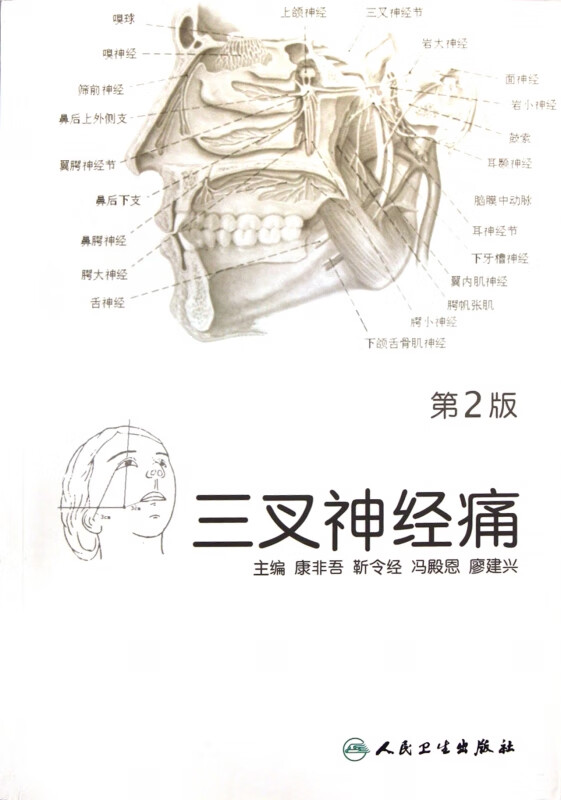 三叉神经痛(第2版)