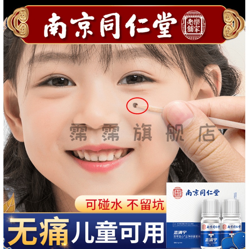 huajicui疣瘊净疣必清南京同仁堂志清宁无痕y水脸部点痣修复液取痣