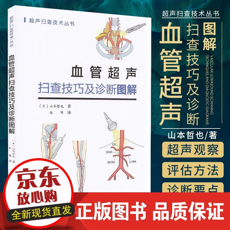 血管超声扫查技巧及诊断图解 山本哲也 著 超声扫查技术丛书 椎动脉系统的解剖 主动脉超声怎么看?