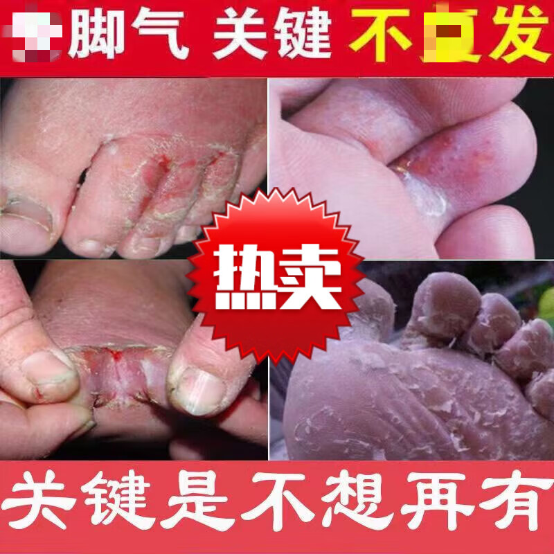 造福堂老专家草本抑菌乳膏外用老专家软膏儿童成人造福止痒膏堂 买3+2【五盒巩固装】