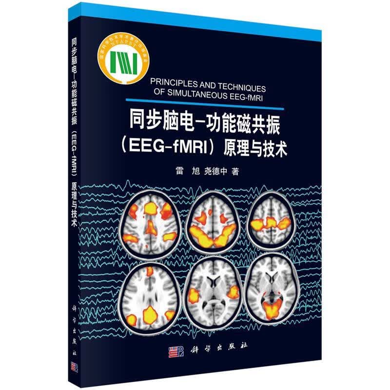 同步脑电-功能磁共振原理与技术