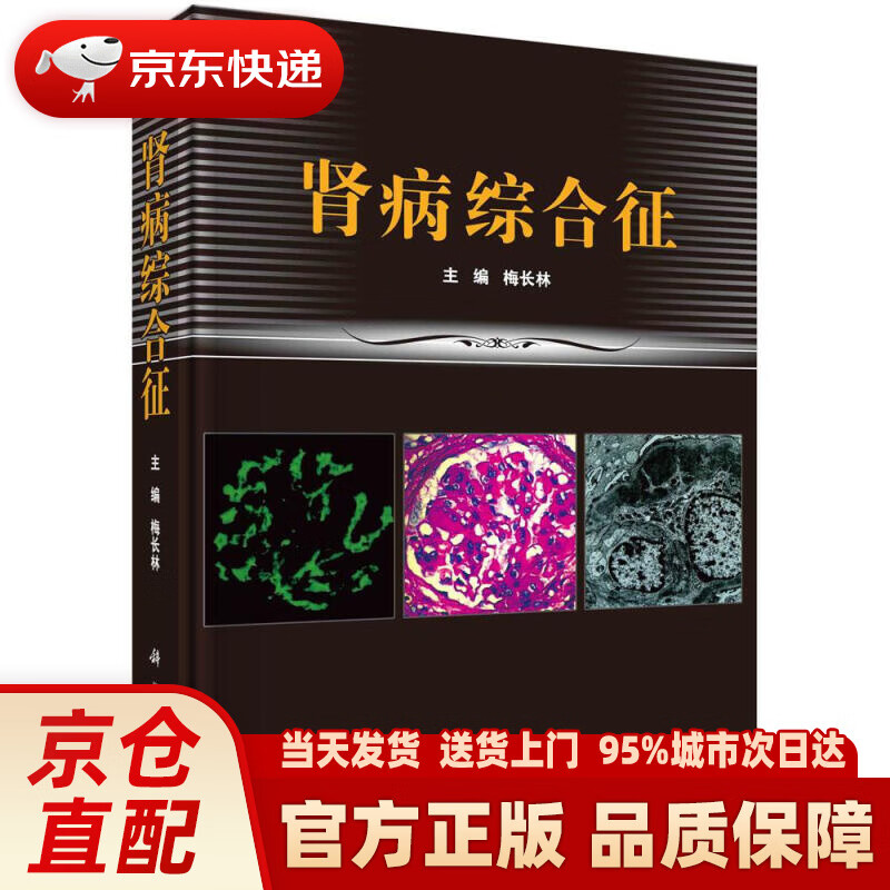 【新华正版图书】肾病综合征 梅长林 科学出版社有限责任公司