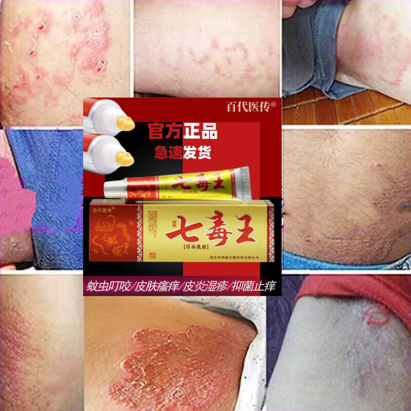 阴囊蛋痒外阴潮湿湿l疹疙瘩红l疹成人私处皮l炎过敏痒红l斑点乳膏红肿