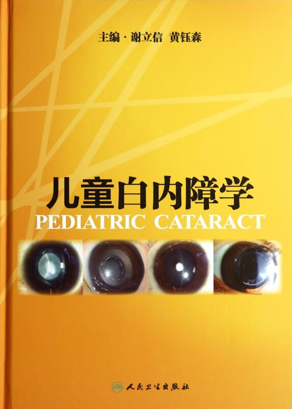 儿童白内障学(精)