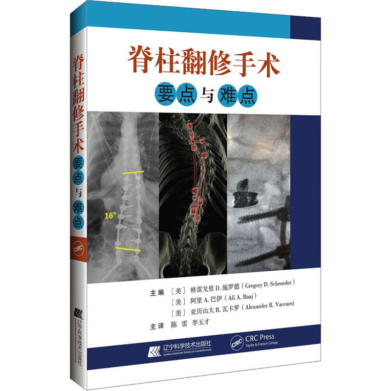 脊柱翻修手术要点与难点 图书