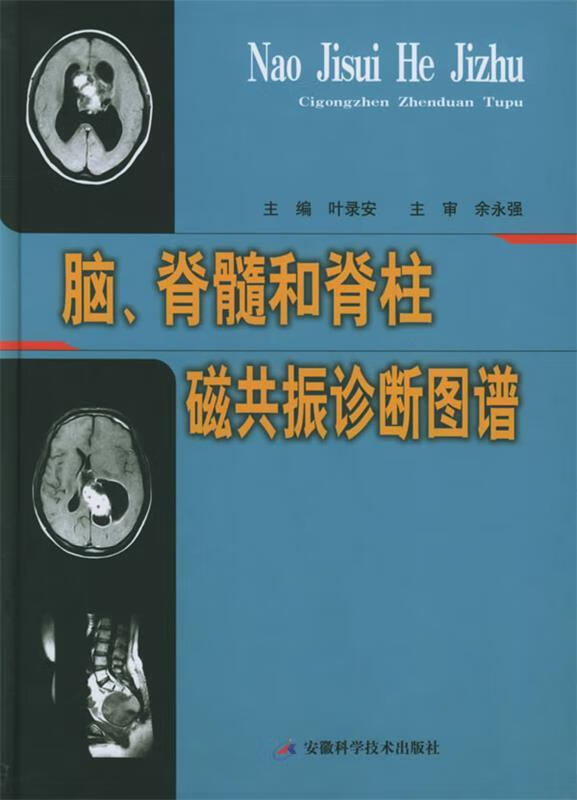 脑、脊髓和脊柱磁共振诊断图谱