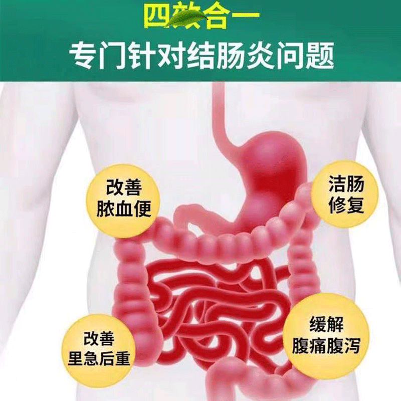 古都老方结肠贴肠炎肠胃贴成人儿童腹泻腹痛拉肚子肚脐贴慢性结肠炎调理 一盒装