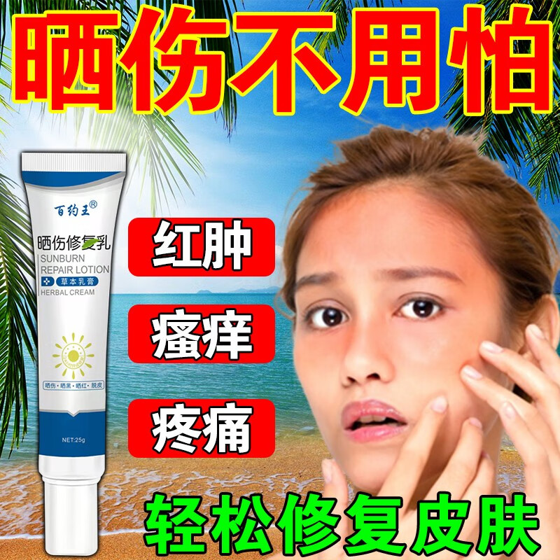 紫外线晒伤膏日光性皮炎过敏脱皮专用中药抹膏旅游防晒常备品 一支