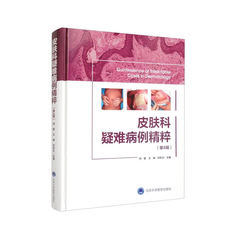 皮肤科疑难病例精粹(第4辑)