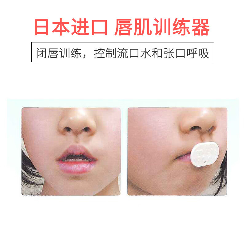 儿童张嘴睡觉1器口呼吸1器闭嘴神器嘴巴睡觉防张嘴张口嘴凸唇肌训练器