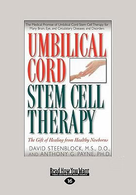 预订umbilical cord stem cell therapy: the gift of he