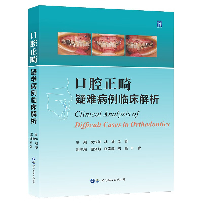 口腔正畸疑难病例临床解析