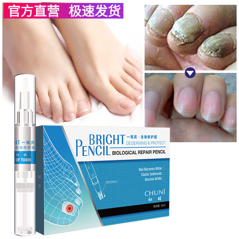初妮（CHUNI）初妮 一笔亮消菌去灰灰生物修护膜手足部护理灰指甲去除修 3ml*4/盒(初妮)