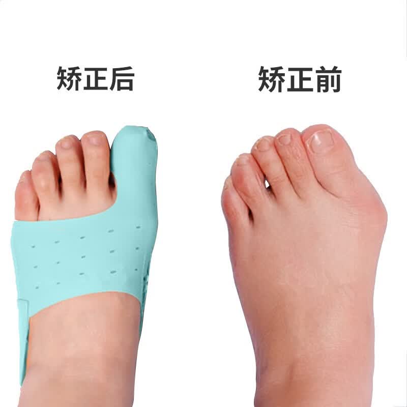 远足脚趾矫正器透气拇外翻校正大脚骨突出儿童母外反纠正轻薄男女