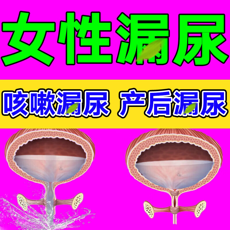 修复失禁产后遗尿咳嗽打喷嚏大笑尿频尿急尿不尽夜尿增多专用中药贴