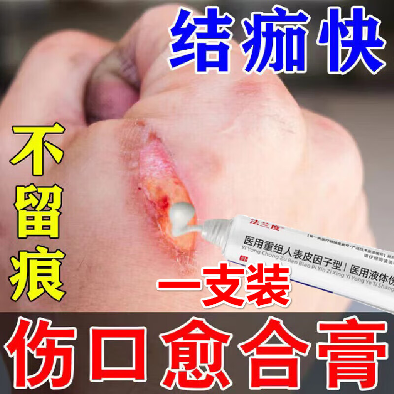 nhfouyou牛碱性成纤维细胞生长因子凝胶伤口l愈合结痂生l肌膏擦伤烫伤