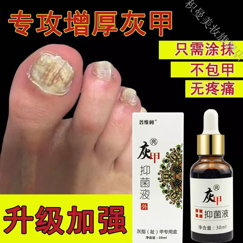 甲郎中甲骨甲康灰指甲旗舰店康甲修复液灰甲正榀消液除增厚久木堂